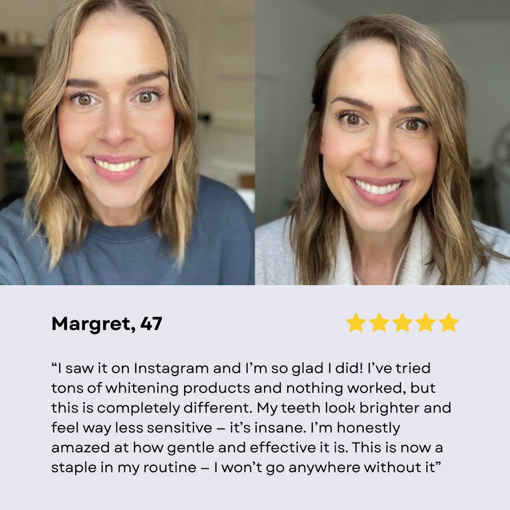 bryte®  Niacinamide Whitening Toothpaste