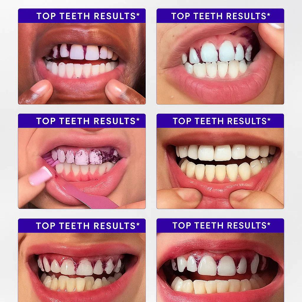 Bryte™ Purple Whitening Strips