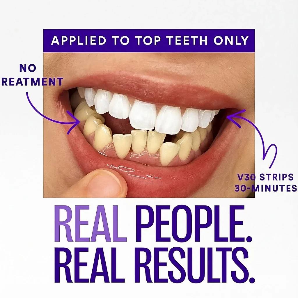 Bryte™ Purple Whitening Strips